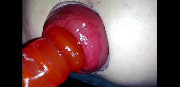  anal-extreme-gay-plug-prolapse-pump-rosebud gay prolapse